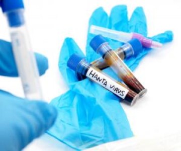 A fost confirmat primul caz de hantavirus în România, la un pacient din ...