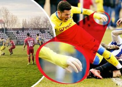 Caz revoltător în România! Fotbalistul cu proteză, care a făcut înconjurul ...