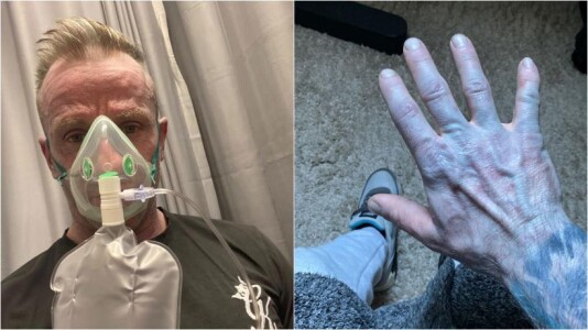 Un bărbat s-a dus la Urgențe cu pielea albastră. Panicați, medicii i-au pus ...